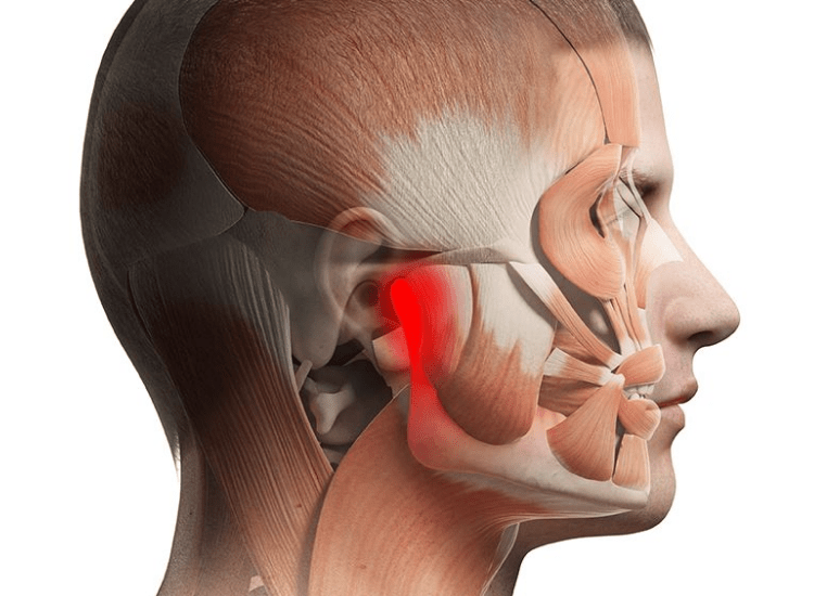 TMJ Treatment